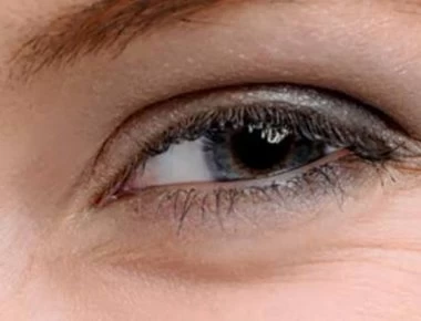 Γιατί οι ρυτίδες είναι πιο έντονες γύρω από τα μάτια